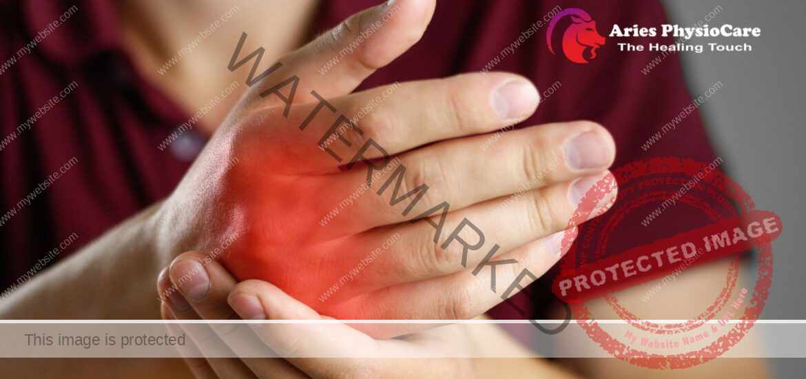 Arthritis and Physiotherapy: A Comprehensive Approach to Managing Joint Pain Arthritis and Physiotherapy: A Comprehensive Approach to Managing Joint Pain