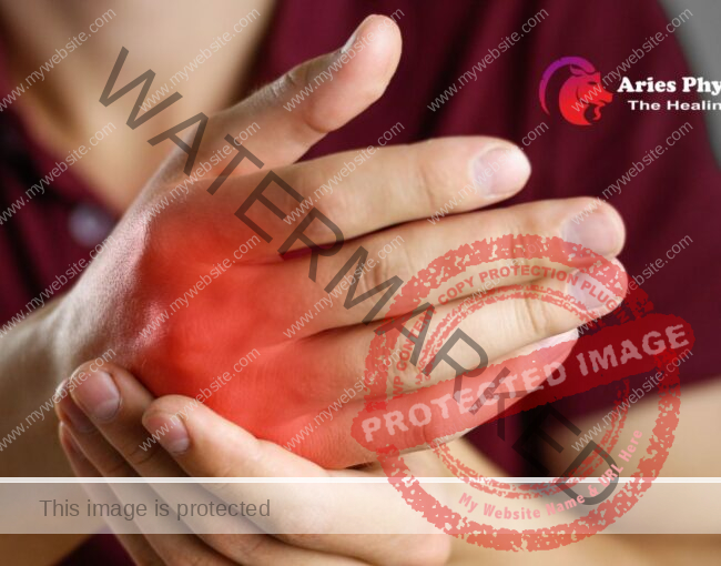 Arthritis and Physiotherapy: A Comprehensive Approach to Managing Joint Pain