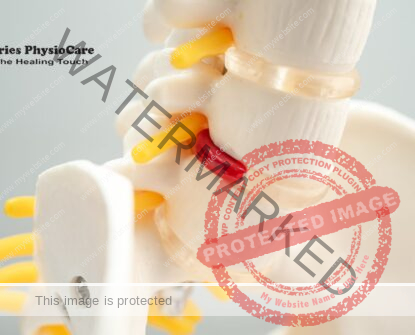 Non-Surgical Recovery from Back Pain with Disc Bulge: Advancements in Physiotherapeutic Interventions Non-Surgical Recovery from Back Pain with Disc Bulge: Advancements in Physiotherapeutic Interventions