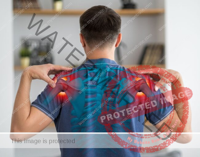 Frozen Shoulder and Rehabilitation Exercises