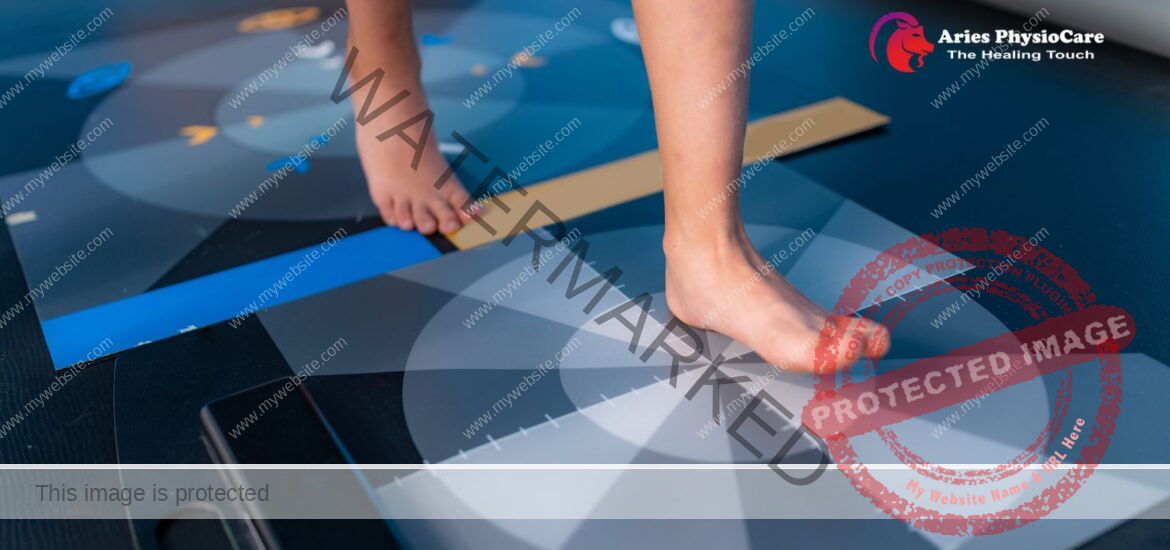 Gait Analysis and Correction Through Physiotherapy Gait Analysis and Correction Through Physiotherapy