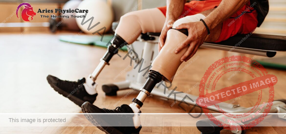 Prosthetic Training and Functional Recovery Prosthetic Training and Functional Recovery