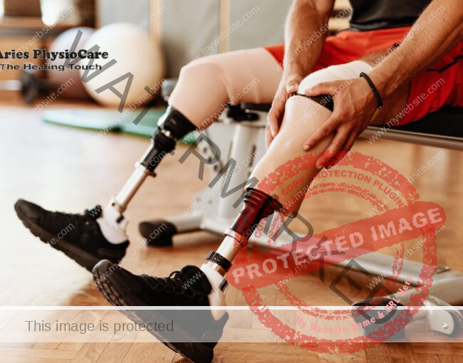 Prosthetic Training and Functional Recovery