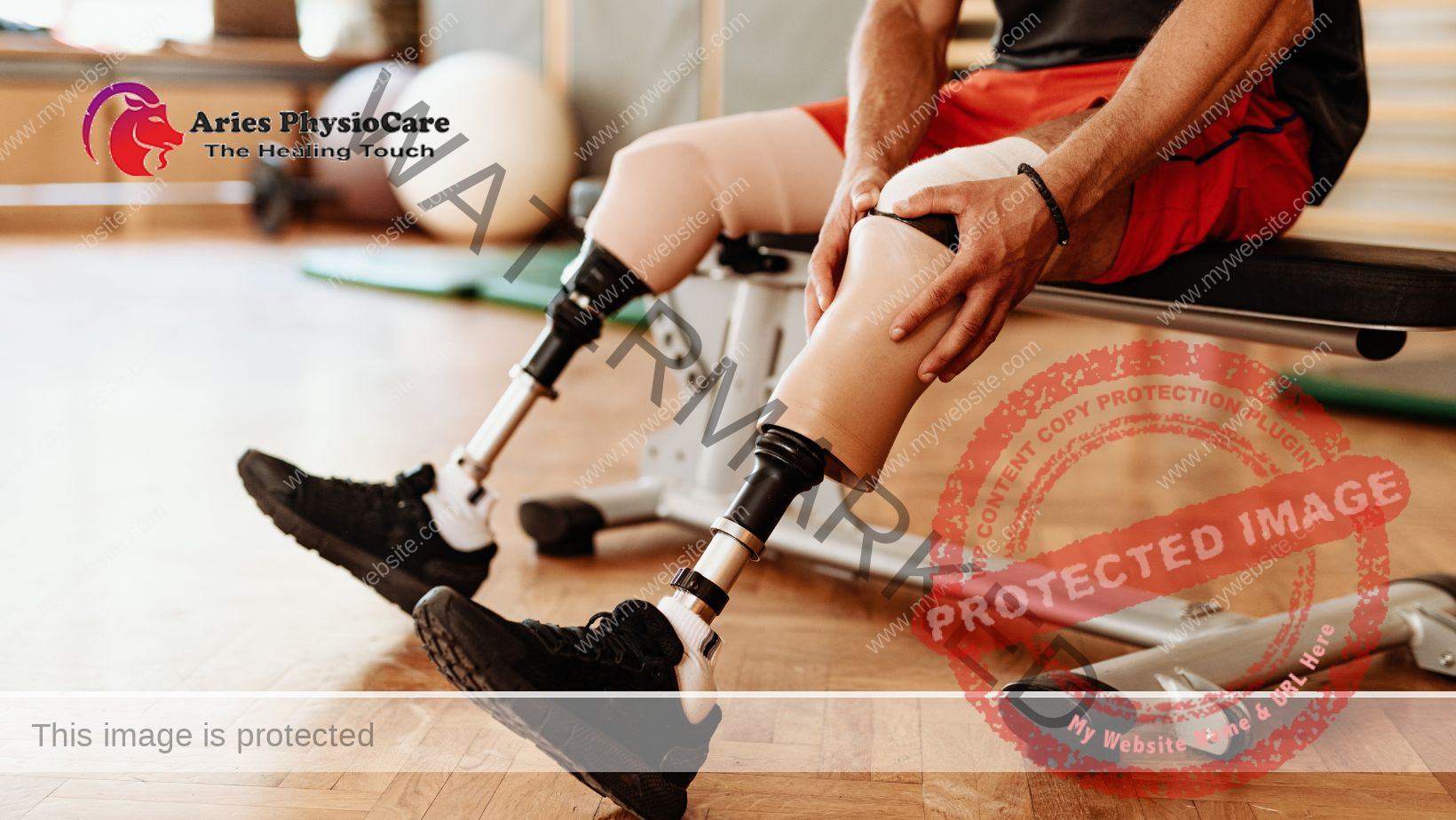 Prosthetic Training and Functional Recovery Prosthetic Training and Functional Recovery