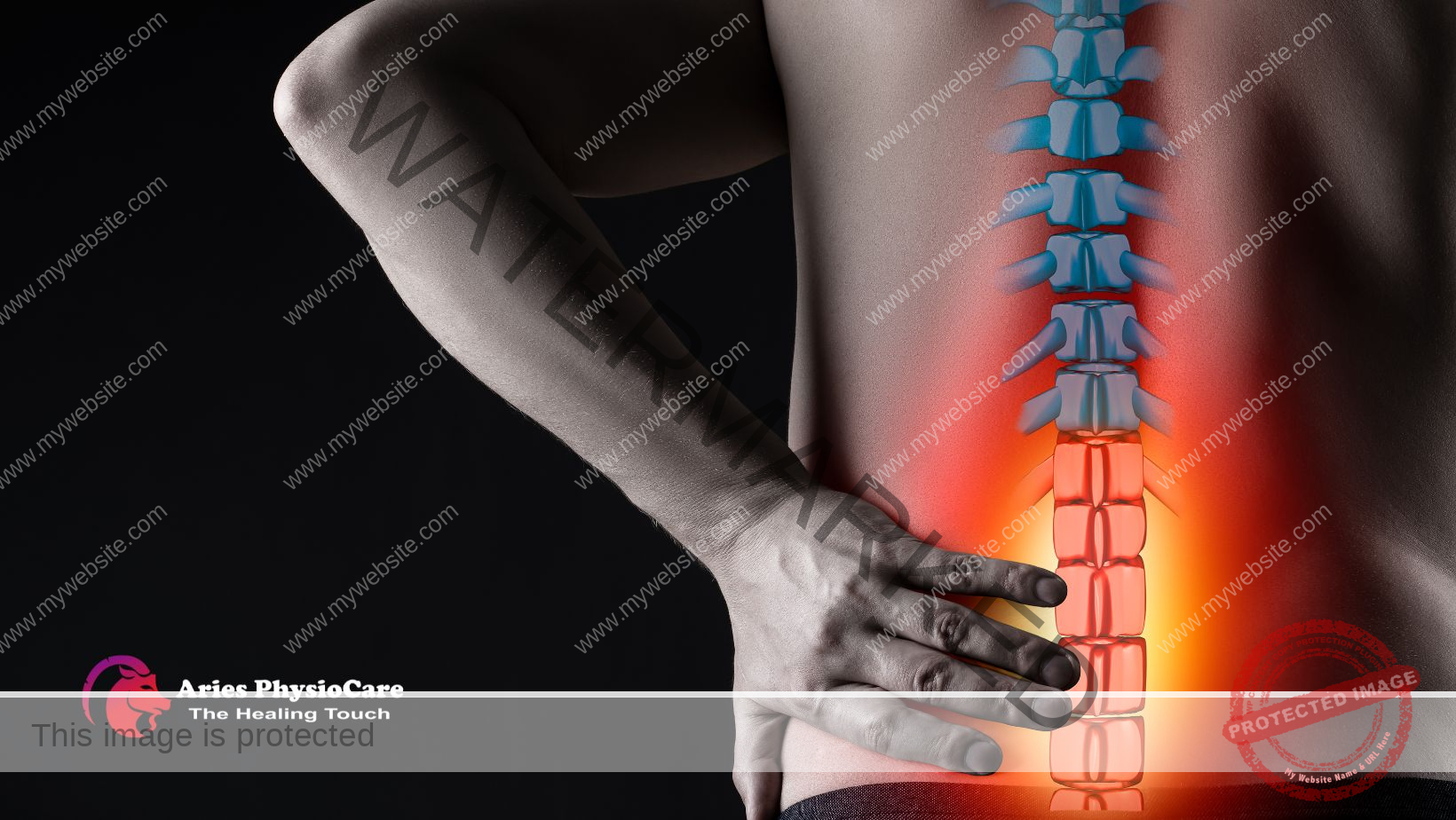 Sciatica Recovery Without Surgery: Aries PhysioCare's Comprehensive Approach