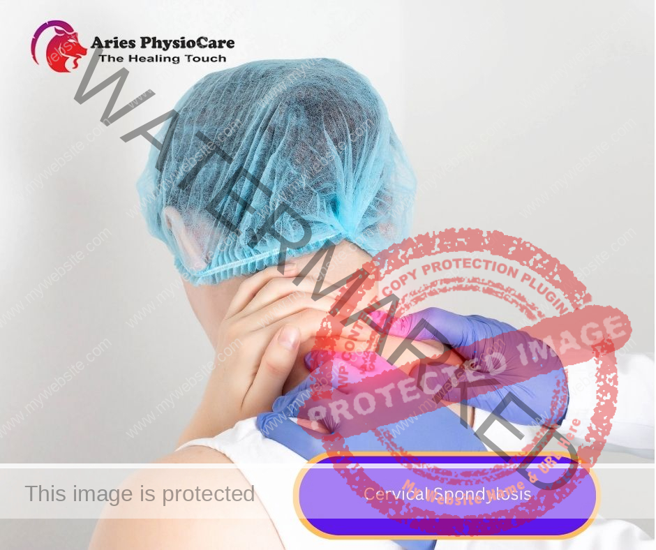 Cervical Spondylosis Cervical Spondylosis