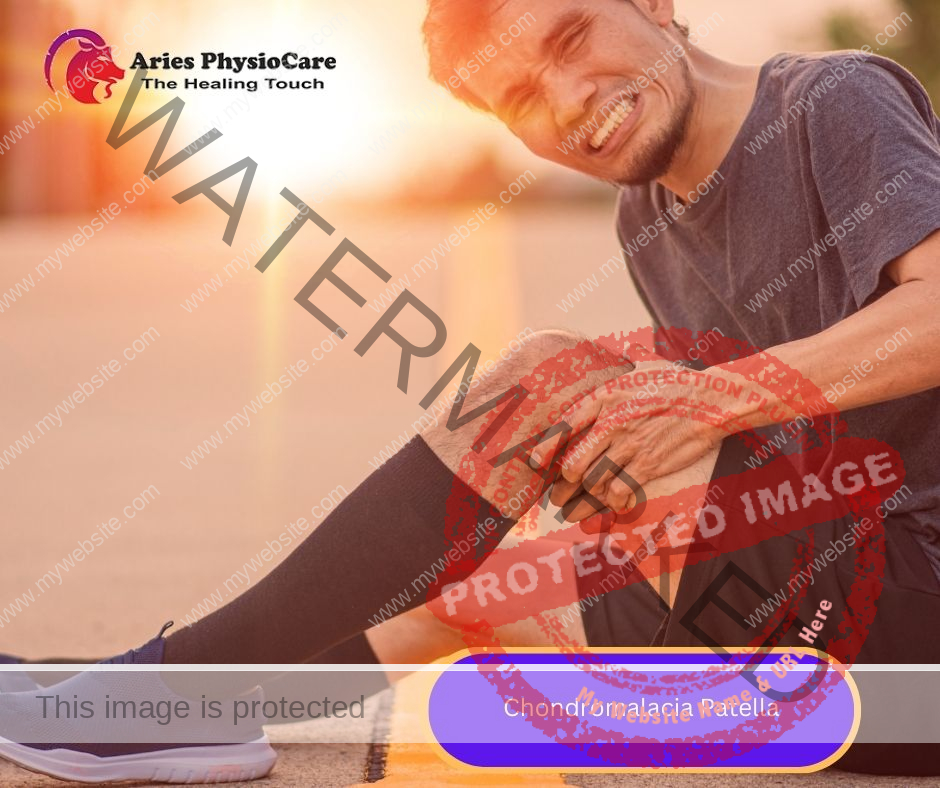 Chondromalacia Patella Chondromalacia Patella