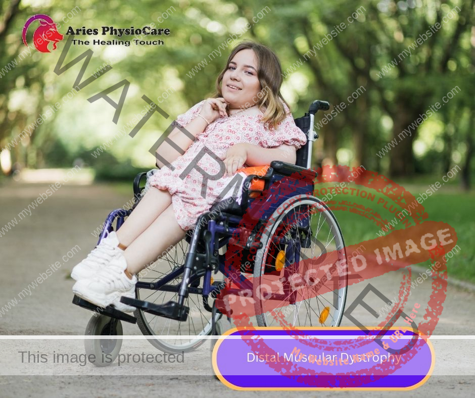 Distal Muscular Dystrophy Distal Muscular Dystrophy