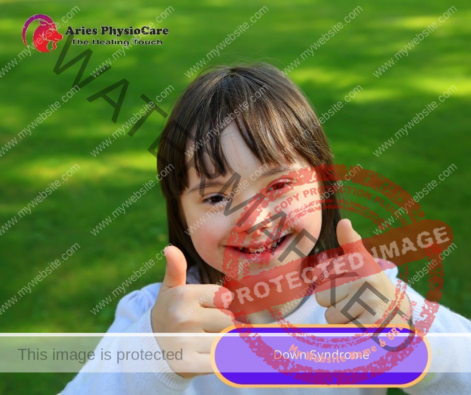 Down Syndrome Down Syndrome