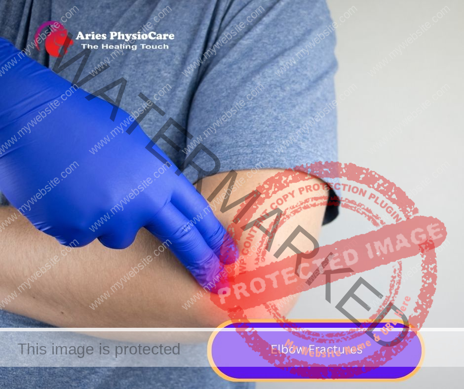 Elbow Fractures Elbow Fractures