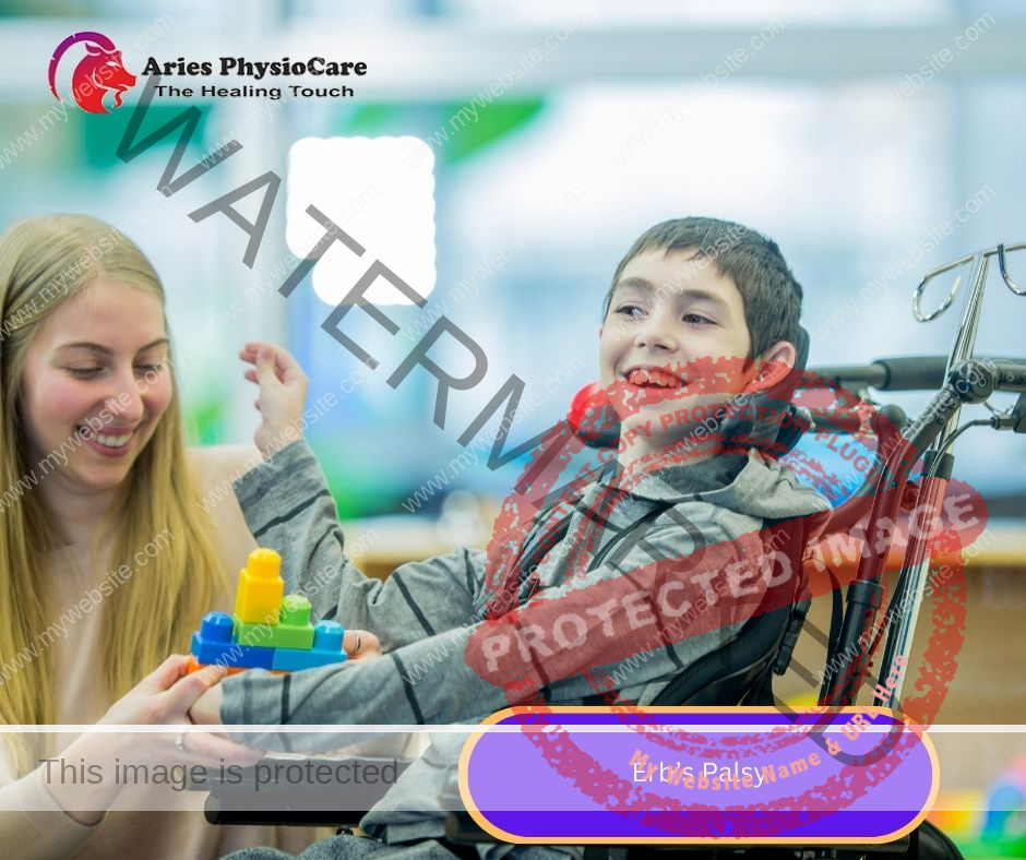 Erb’s Palsy Erb’s Palsy