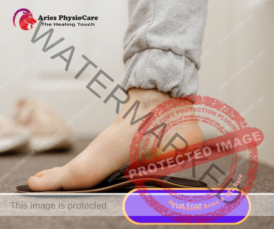 Flat Foot Flat Foot