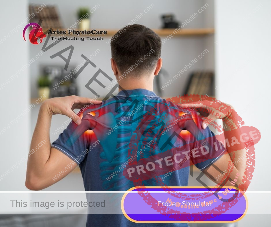 Frozen Shoulder Frozen Shoulder