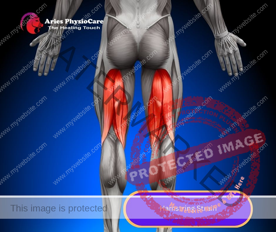 Hamstring Strain Hamstring Strain