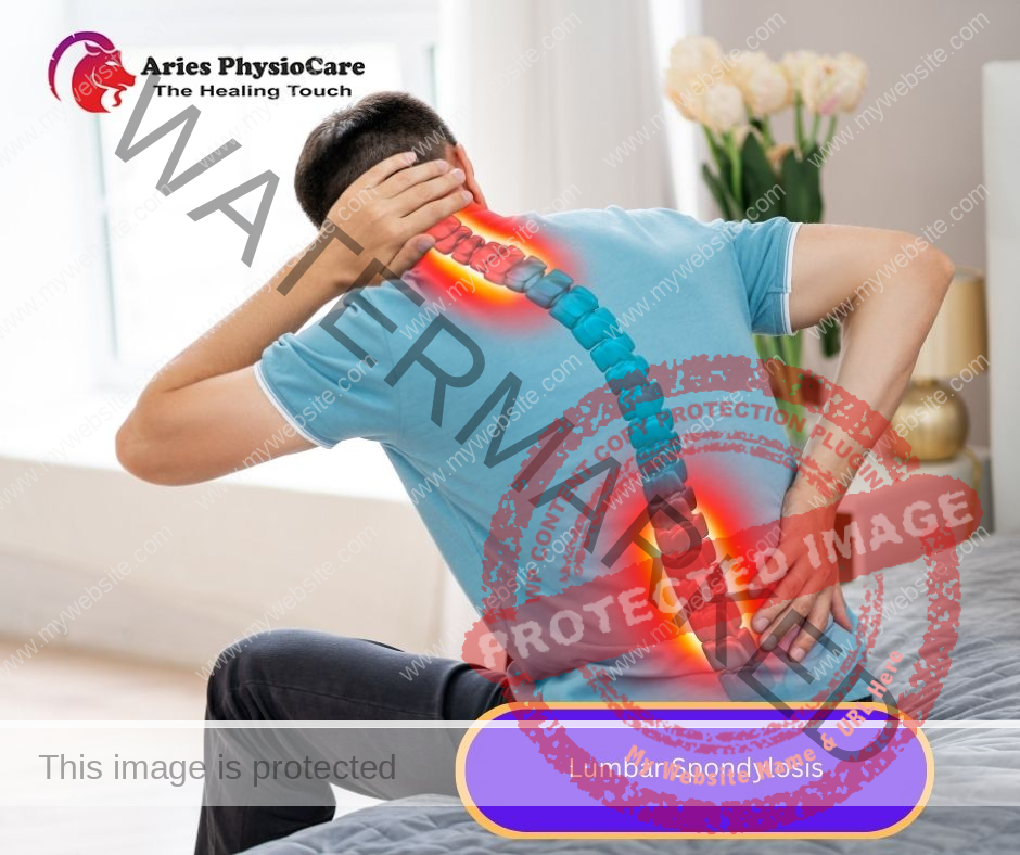 Lumbar Spondylosis Lumbar Spondylosis
