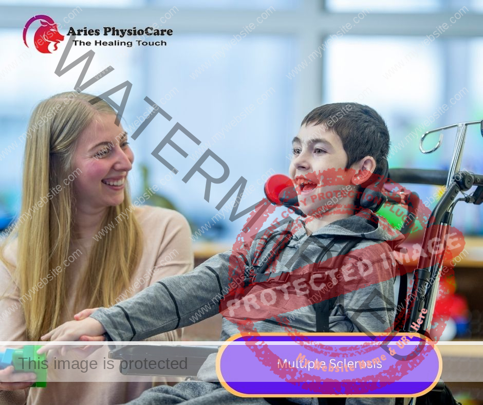 Multiple Sclerosis Multiple Sclerosis