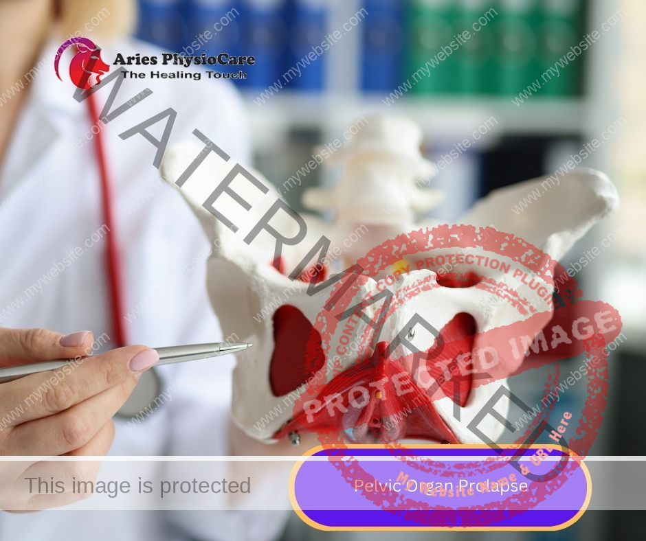 Pelvic Organ Prolapse Pelvic Organ Prolapse