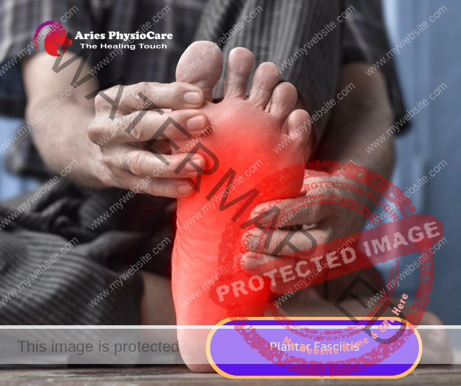 Plantar Fasciitis Plantar Fasciitis