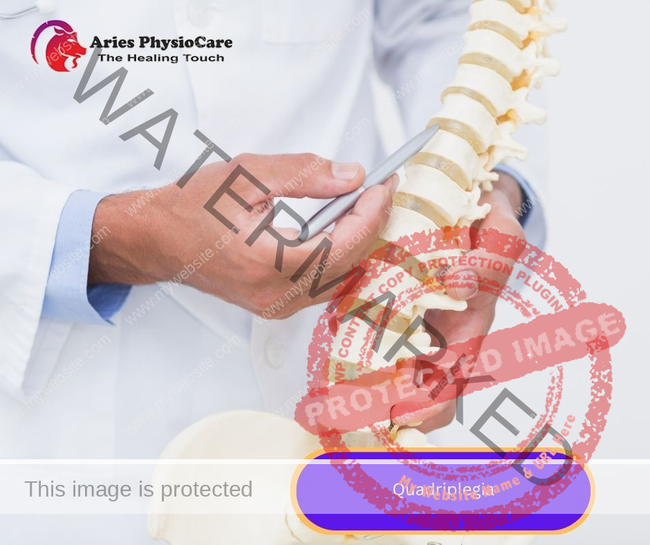 Quadriplegia Quadriplegia