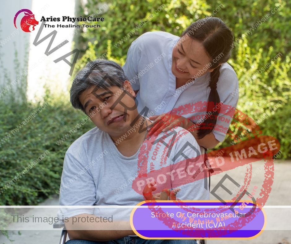 Stroke Or Cerebrovascular Accident (cva) Stroke Or Cerebrovascular Accident (cva)