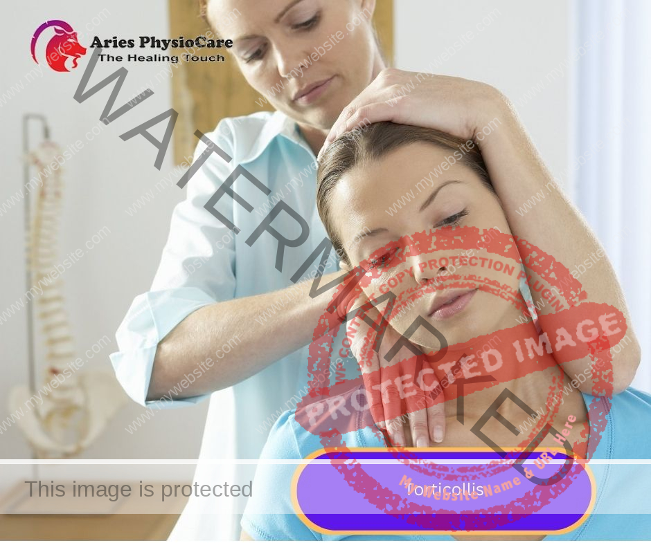Torticollis Torticollis