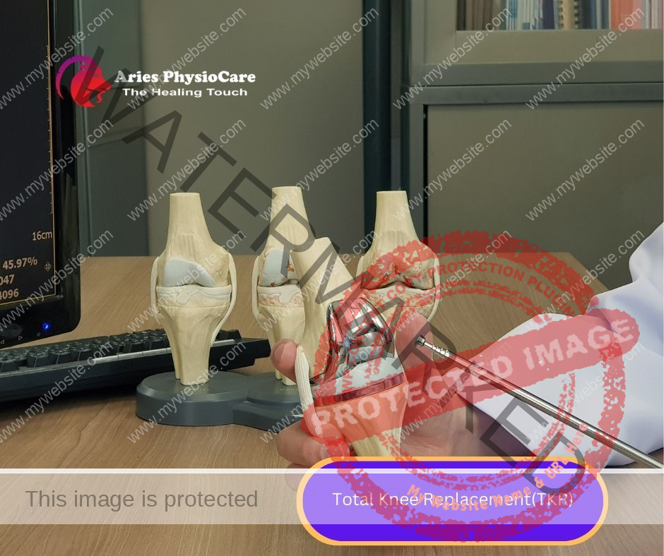 Total Knee Replacement(tkr) Total Knee Replacement(tkr)