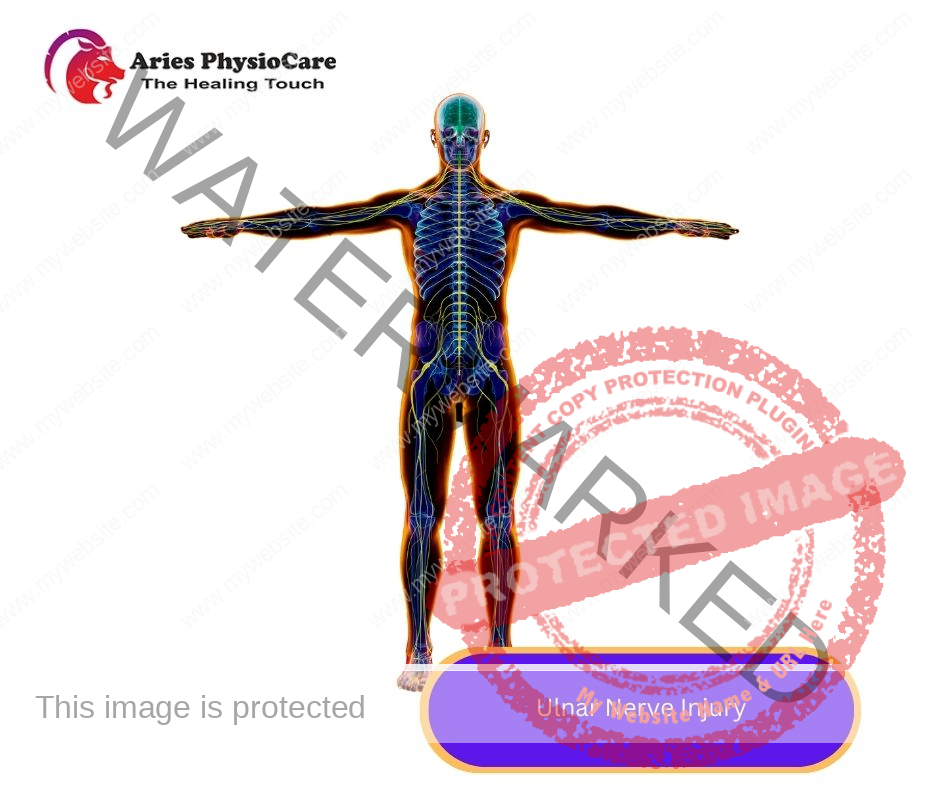 Ulnar Nerve Injury Ulnar Nerve Injury