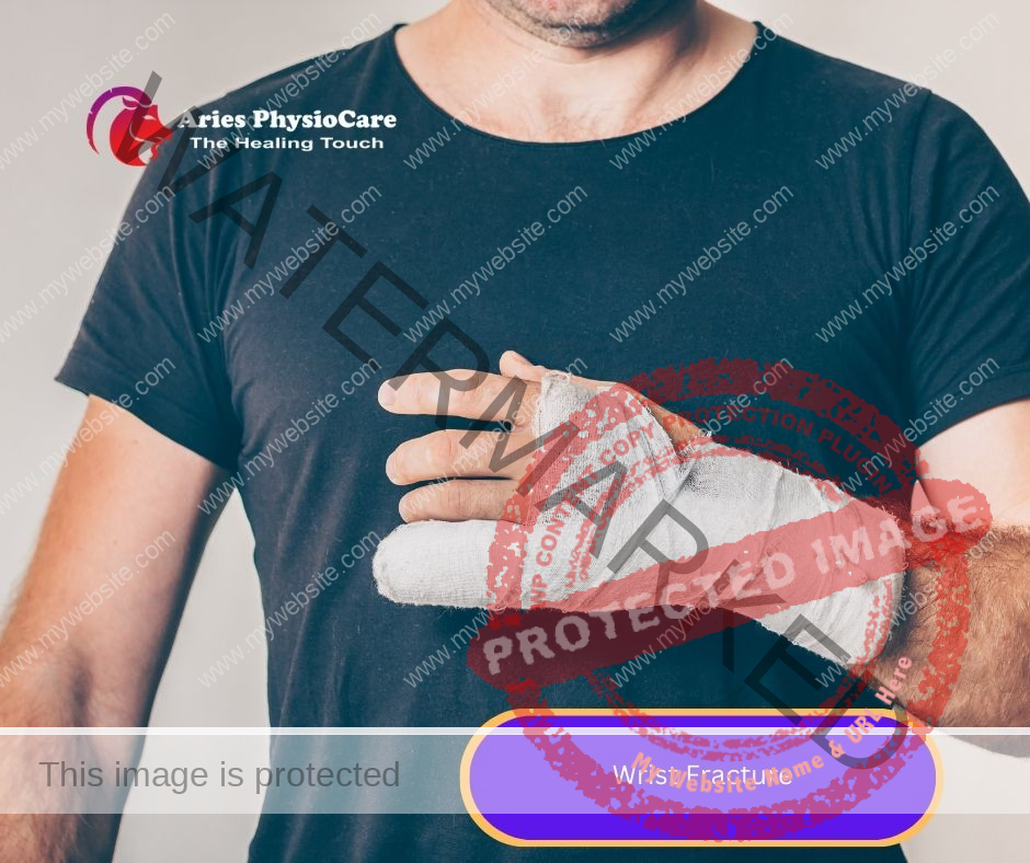 Wrist Fracture Wrist Fracture